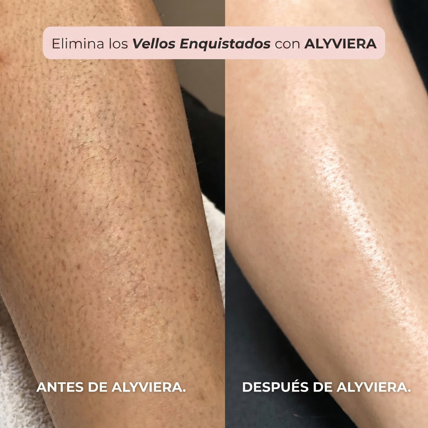 Maquinilla 2 en 1 para Bikini y Cuerpo Alyviera™