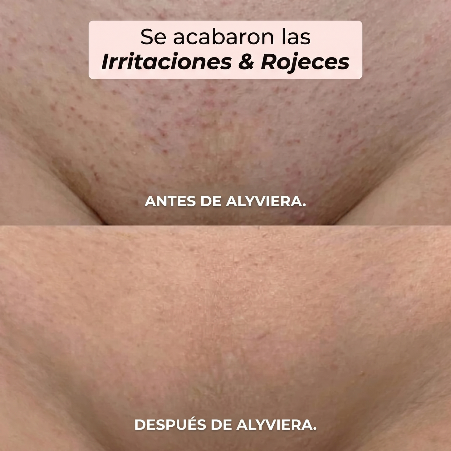 Maquinilla 2 en 1 para Bikini y Cuerpo Alyviera™