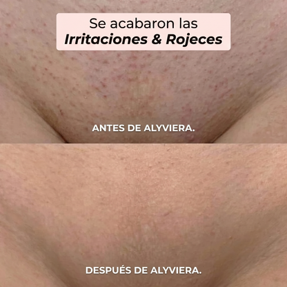 Maquinilla 2 en 1 para Bikini y Cuerpo Alyviera™