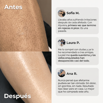 Maquinilla 2 en 1 para Bikini y Cuerpo Alyviera™