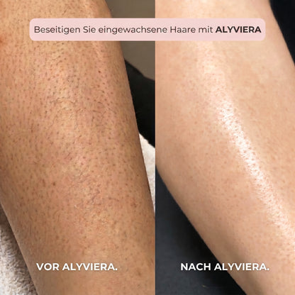 TRIMMER 2-IN-1 FÜR BIKINI UND KÖRPER ALYVIERA™