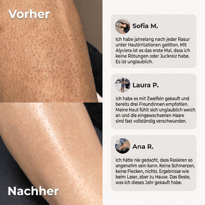 TRIMMER 2-IN-1 FÜR BIKINI UND KÖRPER ALYVIERA™