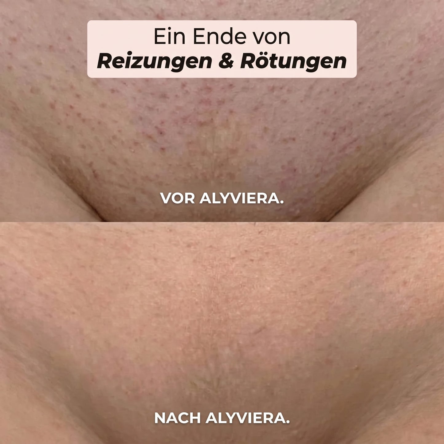 TRIMMER 2-IN-1 FÜR BIKINI UND KÖRPER ALYVIERA™